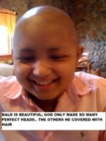 Bald is Beautiful